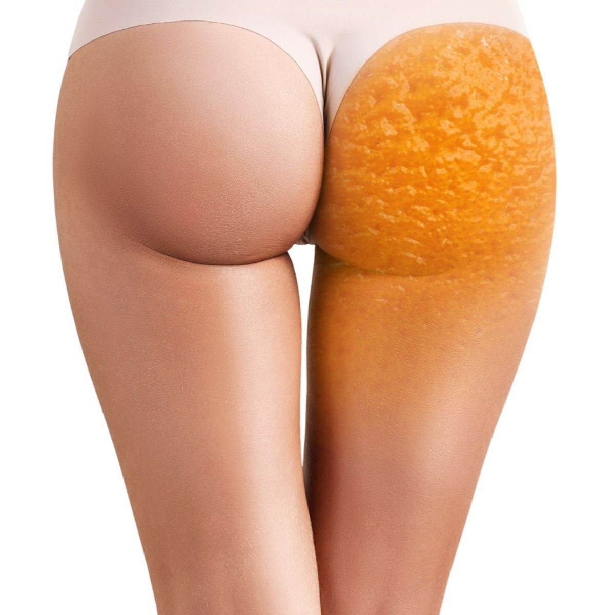 5 сеансов антицеллюлитного массажа + 1 в подарок